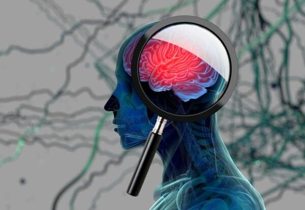 Cognitive Screening